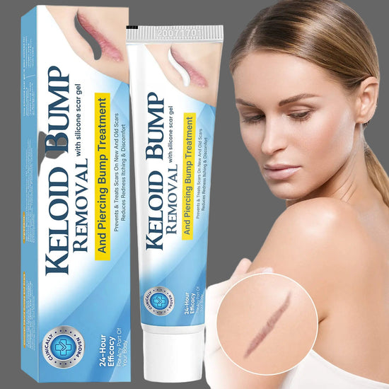 Keloid and Scar Removal Cream-For Stretch Marks, Piercings and Surgery Scars