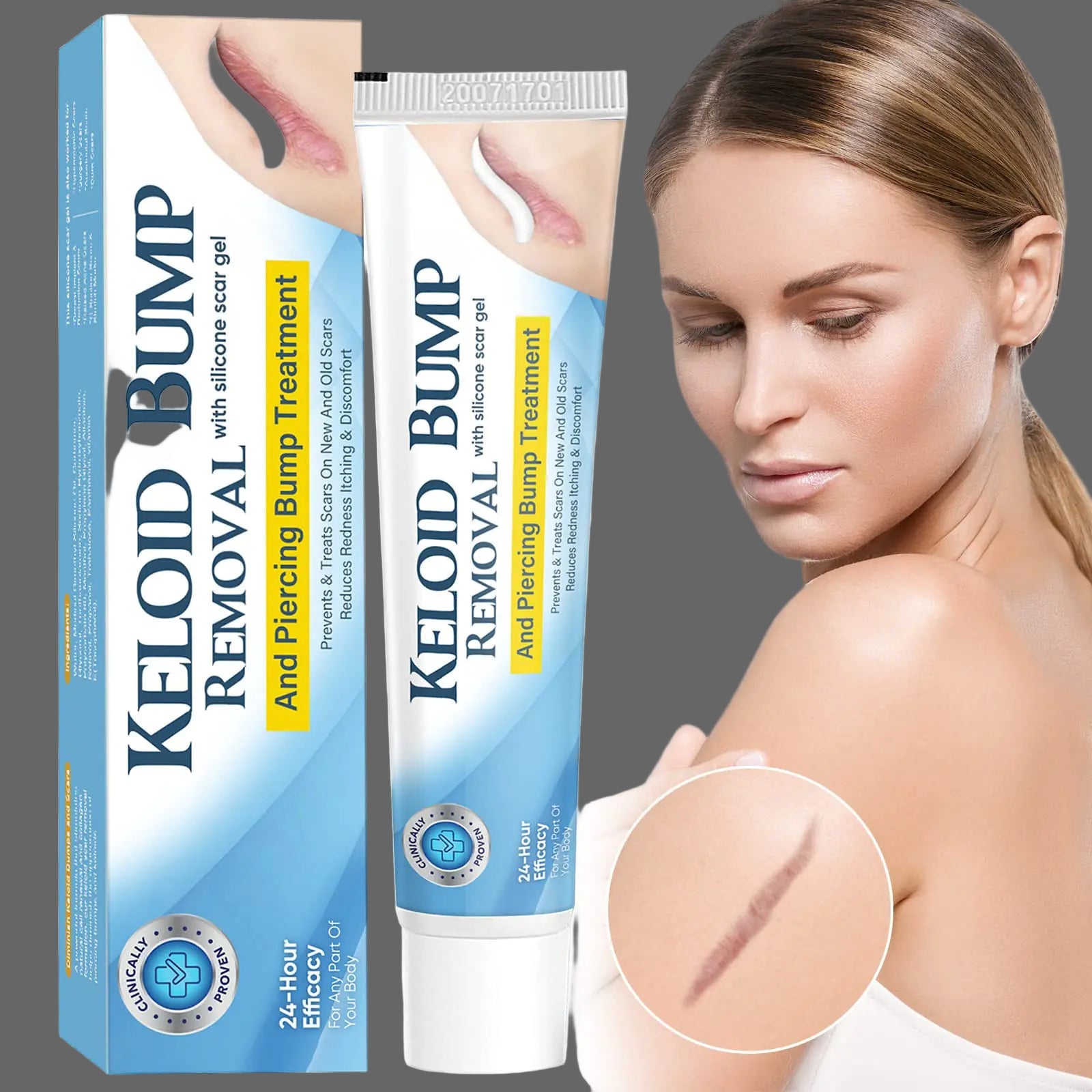 Scar Removal Cream for keloids, stretch marks, belly and ear piercings