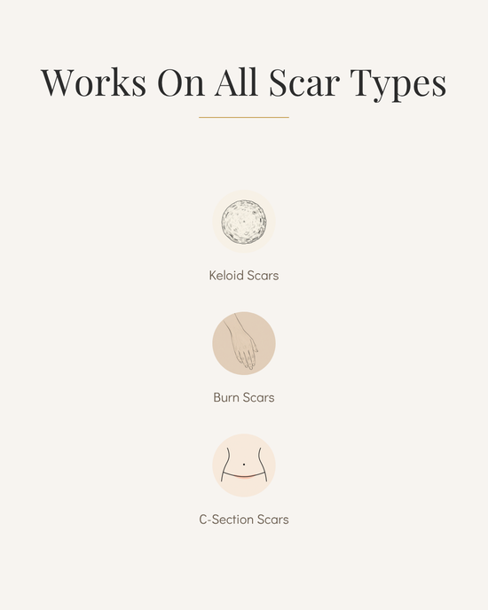 Acne Scar Removal Cream for Skin Repair and Healing