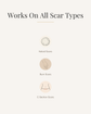 Acne Scar Removal Cream for Skin Repair and Healing